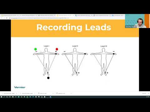 Estimating Heart Axis with EKG Electrode Placement