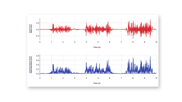 EMG recordings from forearm