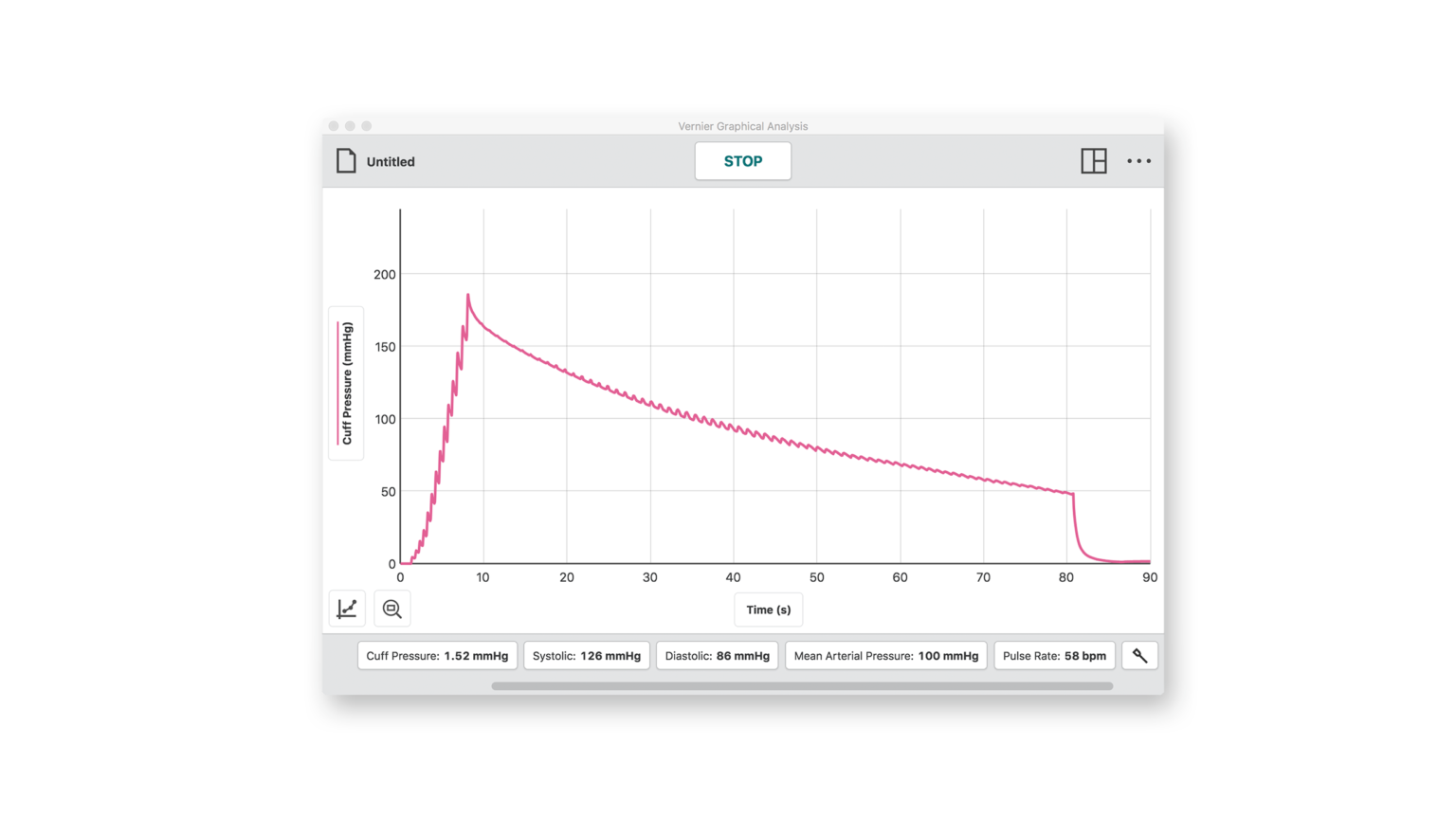 Go Direct® Blood Pressure Sensor Vernier