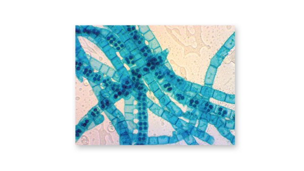Algal cells at 150X