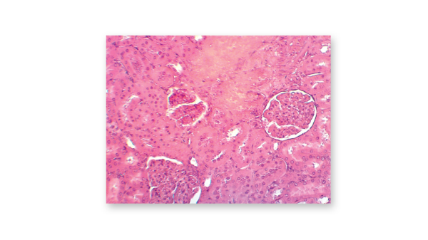 Kidney glomerulus at 150X