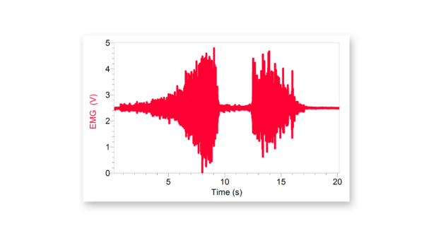 An EMG from the forearm during two periods of contraction