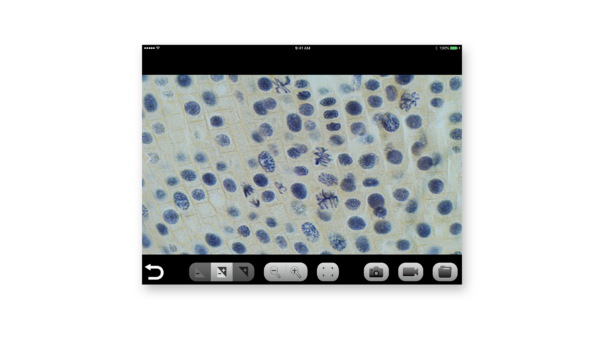 Onion root mitosis at 600x