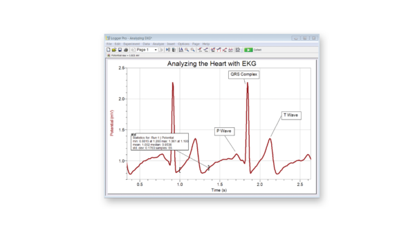 EKG graph demonstrating the electrical events that happen during contraction of the heart's chambers